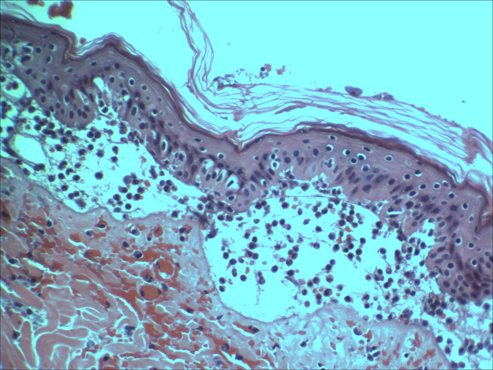 Dermal Burn Modeling | Comparative Biosciences, inc