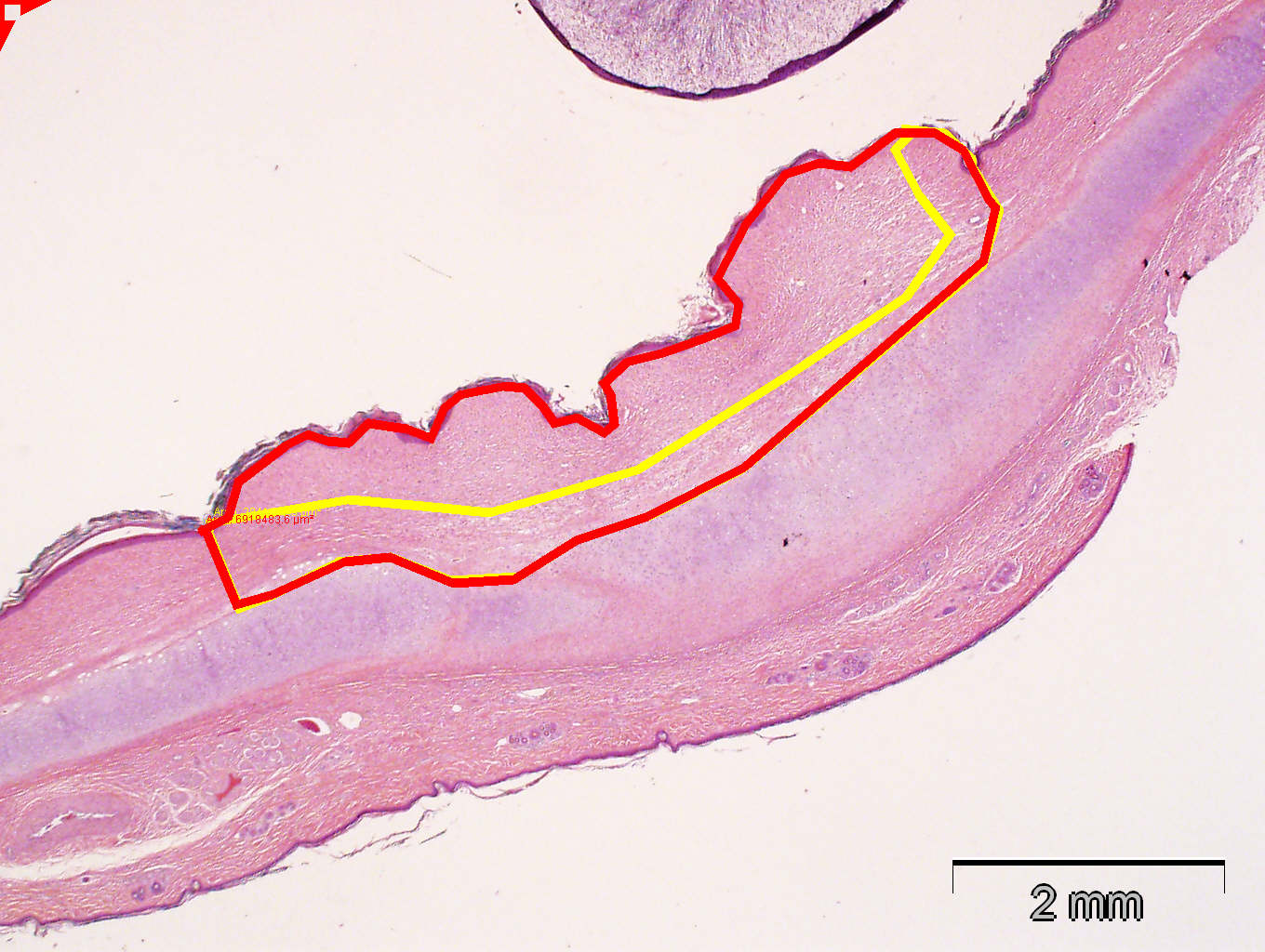 Hyperkeratinization Rabbits Rabbit Hypertrophic Scar or Keloid Model | Comparative Biosciences, inc