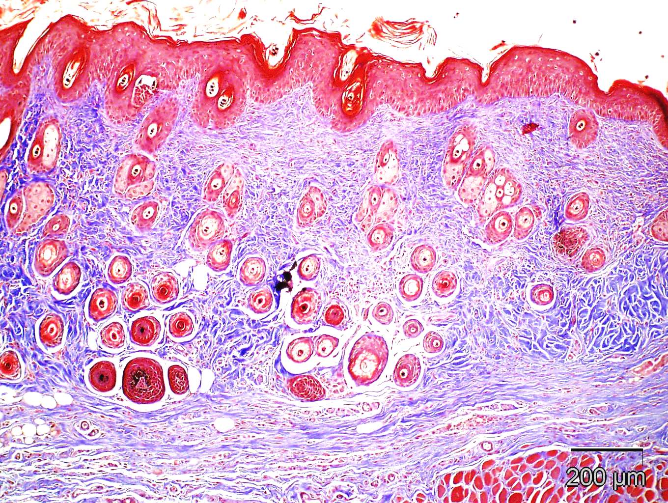 Scleroderma: Tight Skin Mouse Model at CBI | Comparative Biosciences, inc