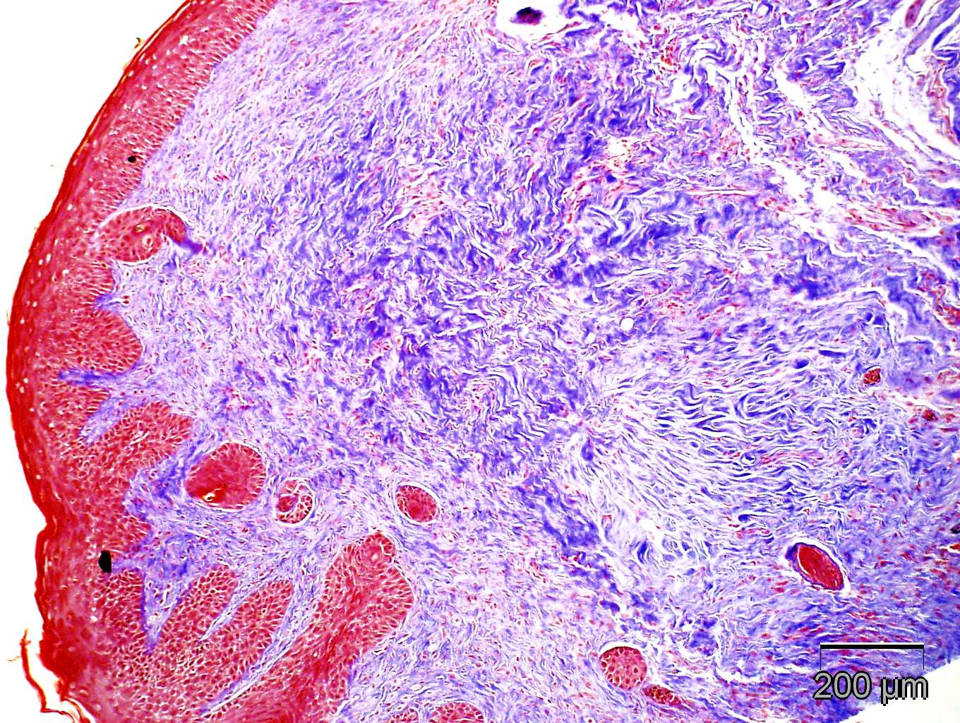Scleroderma: Tight Skin Mouse Model at CBI | Comparative Biosciences, inc