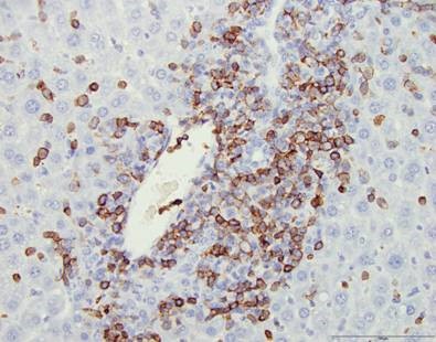 Oncology Histopathology Research