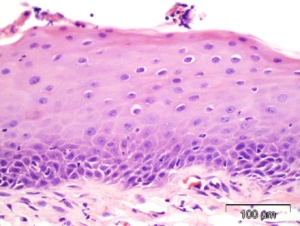 Oncology Histopathology Research