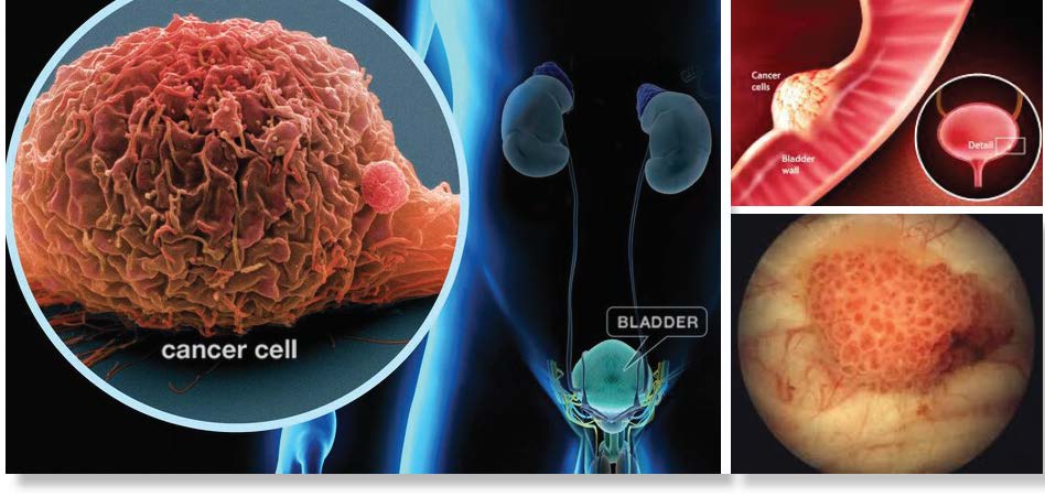 Bladder Cancer - Comparative Biosciences, Inc.